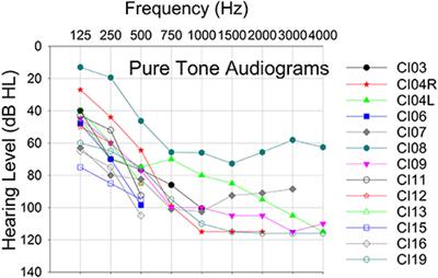 Feasibility of Using Electrocochleography for Objective Estimation of Electro-Acoustic Interactions in Cochlear Implant Recipients with Residual Hearing